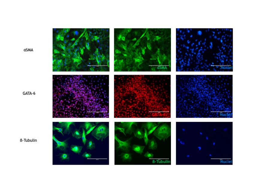 Human iPSC Cell Lines (SV-HiPS20-1-500-Live)