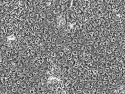 Human iPSC Cell Lines (SV-HiPS20-1-500-Live)